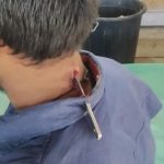 दोस्तों को पैसा नहीं दिया तो गर्दन में चाकू घोंप दिया –