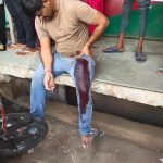 बदमाशों ने दिनदहाड़े शराब दुकान के सेल्समैन को गोली मारी