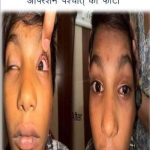Ratlam: रोहित को जल्द मिलेगी आंखों की रोशनी