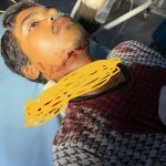 चाइनीज मांझे से युवक की  गले की नस काटने पर, जिला चिकित्सालय के चिकित्सकों ने 18 वर्षीय युवक की जान बचाई